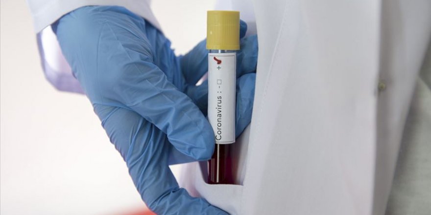 ABD'de Koronavirüs Testi Pozitif Çıkan Kongre Üyesi Sayısı 5'e Yükseldi