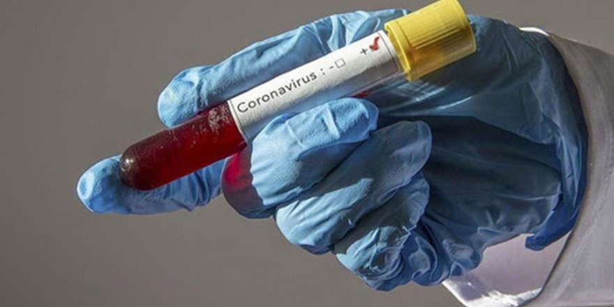 ABD, 2 Dakikada Sonuç Veren Koronavirüs Testine Onay Verdi