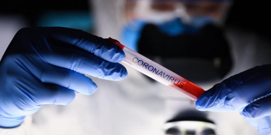 Dünya Genelinde Kovid-19 Bulaşan Kişi Sayısı 2 Milyon 726 Bini Aştı