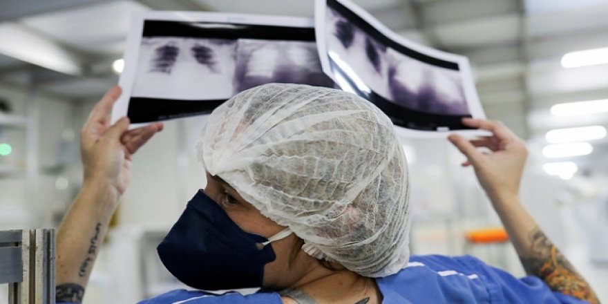 Brezilya'da 1 Günde 1233 Kişi Koronavirüsten Öldü