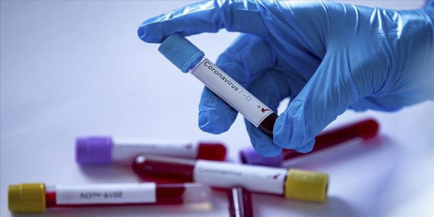 Yeni iddia: Kan grubu 0 olanların koronavirüse yakalanma riski daha az