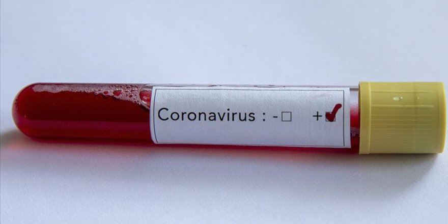 ABD ile DSÖ arasında 'Kovid-19'un kökeni' gerginliği