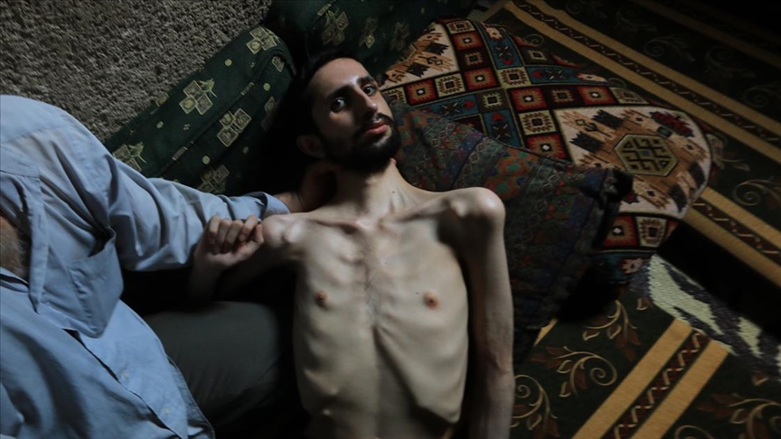 Esed rejiminin sakat ve evsiz bıraktığı Abdullah yardım bekliyor
