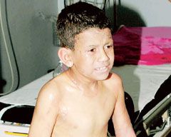 8 yaşında yanık işkencesi