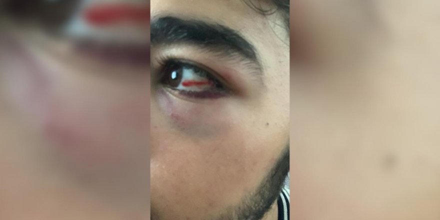 Ümit Özdağ'a kötü haber, yoldaşları enselenmiş!