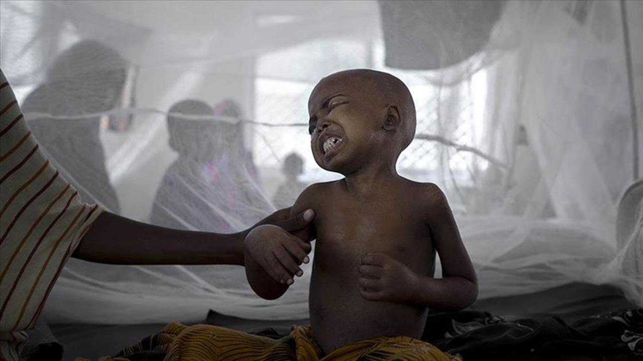 Nijerya'da 117 çocuk difteri salgınından hayatını kaybetti