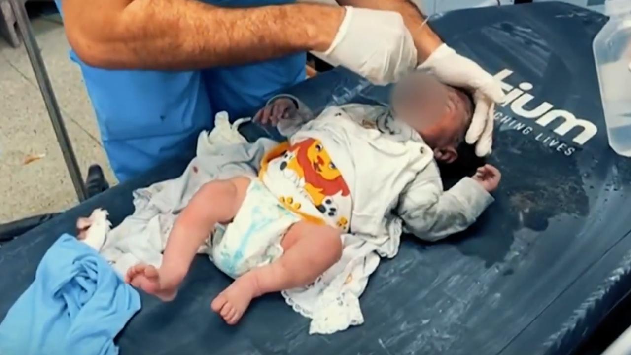 Gazzeli doktorlar anestezi olmadan ameliyat yapıyor