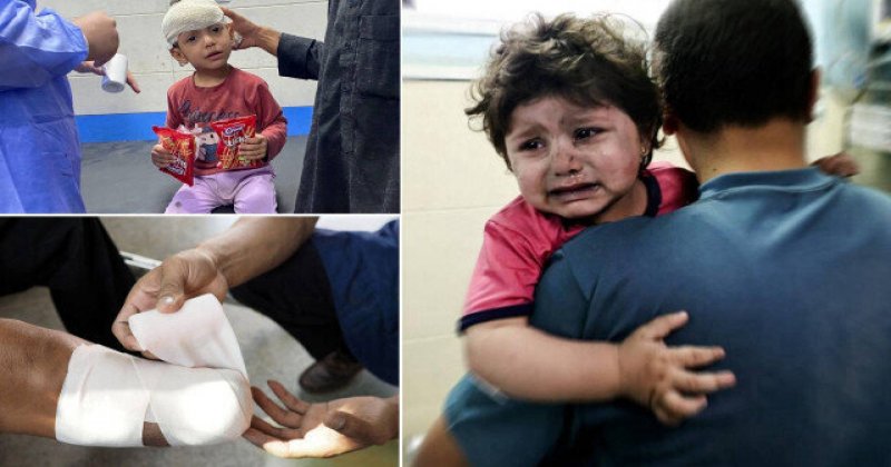 Gazze’deki katliam sonrası yaklaşık 900 çocuk uzuvlarını kaybetti