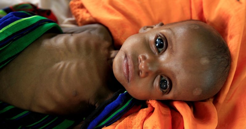 Sudan'da açlıktan ölümler her geçen gün artıyor