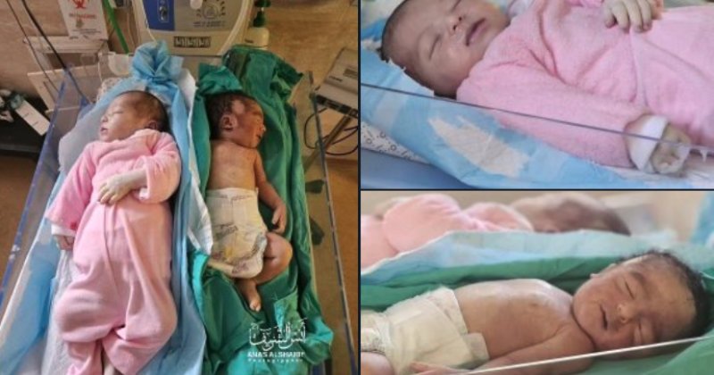 Gazze'de açlıktan ölen bebek sayısı 15'e yükseldi