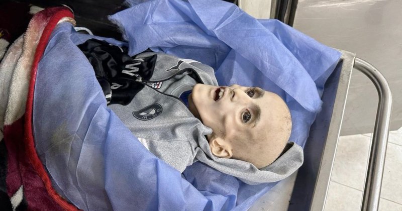 Gazze'deki hastanelerde çocuklar açlıktan ölüyor