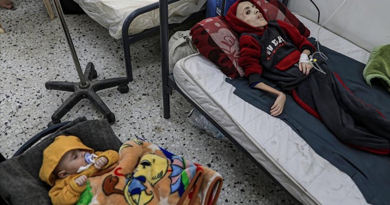 Gazze Sağlık Bakanlığı: Dünya gelecek günlerde çok fazla sayıda açlıktan ölüme tanık olacak