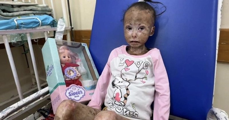 Gazzeli kız çocuğu, hastalık ve açlıkla hayatta kalma savaşı veriyor
