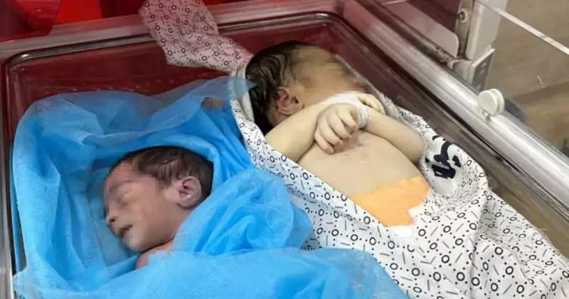 Gazze'de 16 çocuk açlıktan öldü!