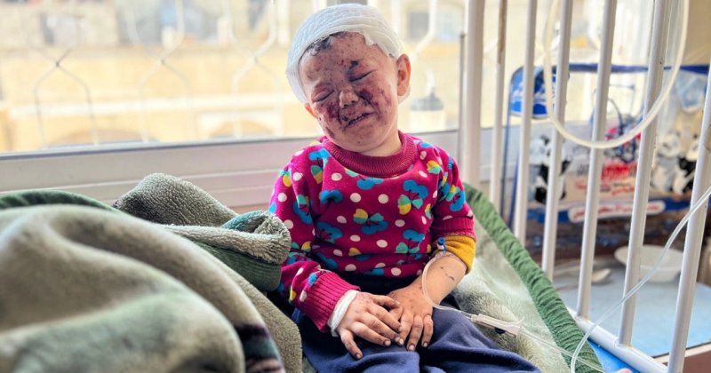 Musab bebeğin hali yürek dağladı