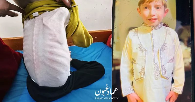 Gazze'de çocukların açlıkla imtihanı