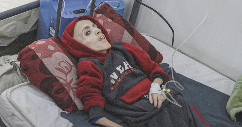 Açlığın anatomisi: "Çok acımasız ve yavaş bir ölüm"