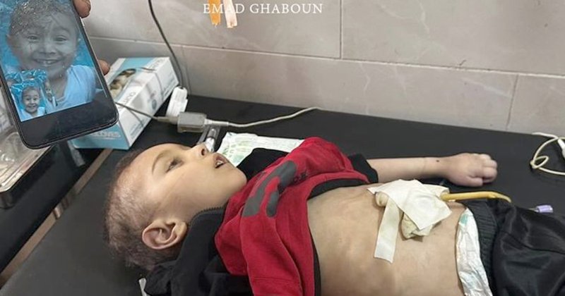 Gazze'de bir çocuk daha açlıktan hayatını kaybetti