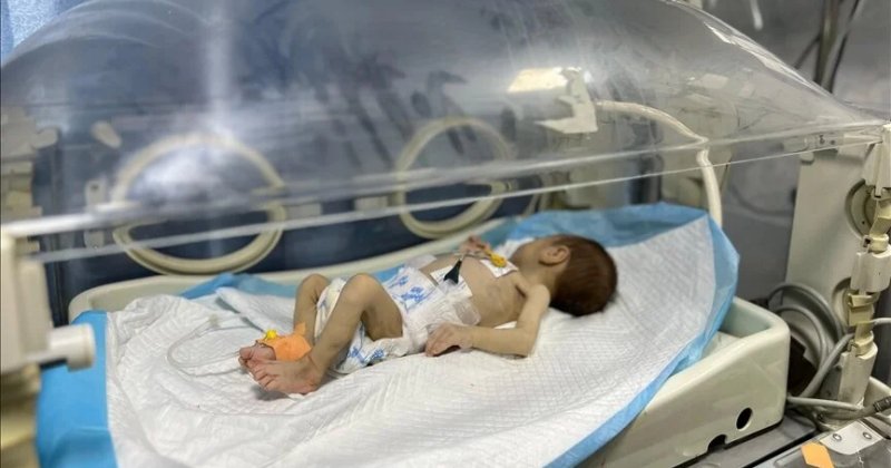 Gazzeli Leyla bebek açlıkla yaşam mücadelesi veriyor