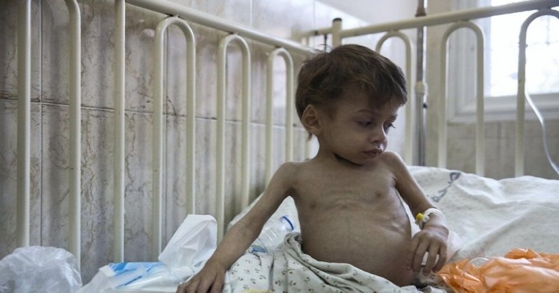 Gazze'de açlık can almaya devam ediyor