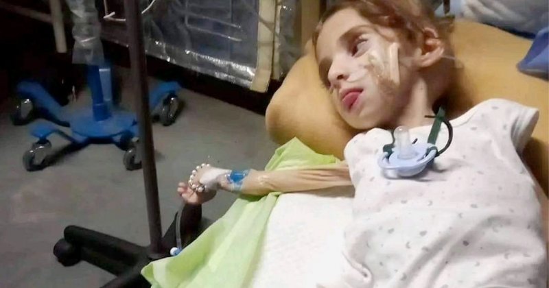 Gazze'de her gün 50 çocuk açlık sebebiyle hastaneye kaldırılıyor