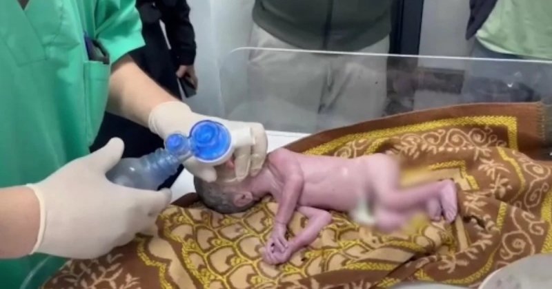 İsrail saldırısında ölen hamile kadının çocuğu kurtarıldı