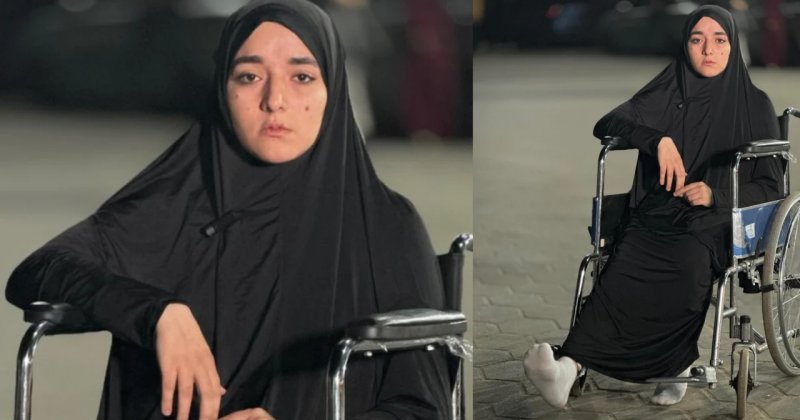 Gazze'de 14 aile üyesini kaybeden genç kız, tedavi için yardım bekliyor