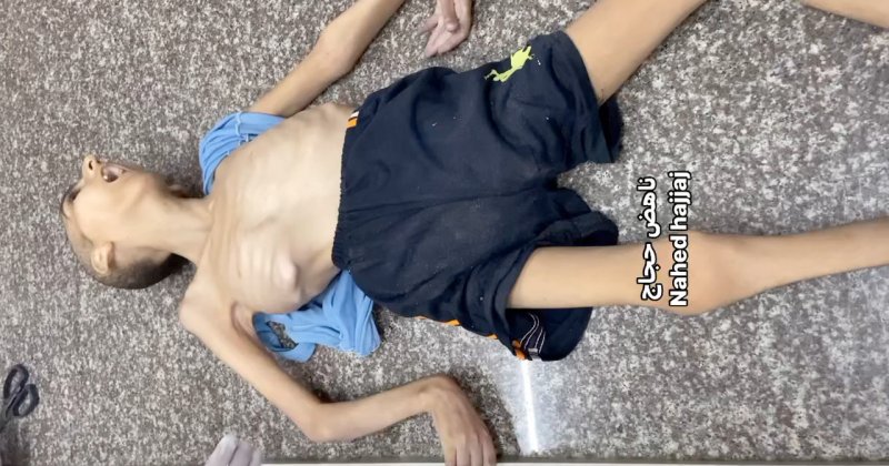 Gazze'de 12 yaşındaki bir çocuk açlıktan vefat etti