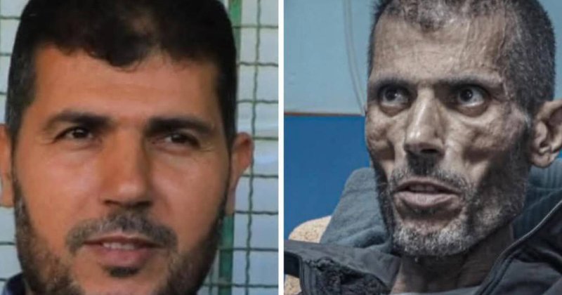 Filistinli mahkum işgal hapishanelerindeki zulmü anlattı