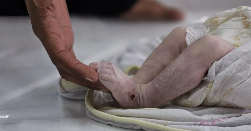 Gazze'de 5 bebek donarak can verdi