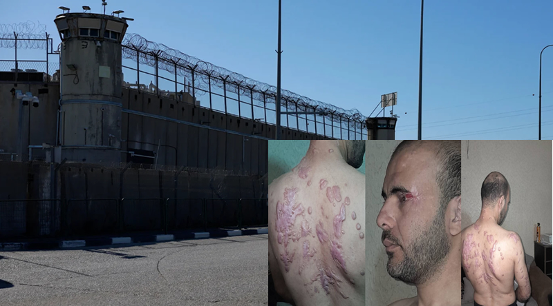 “İsrailli sorgucular işkence sırasında üzerime asit döktüler”
