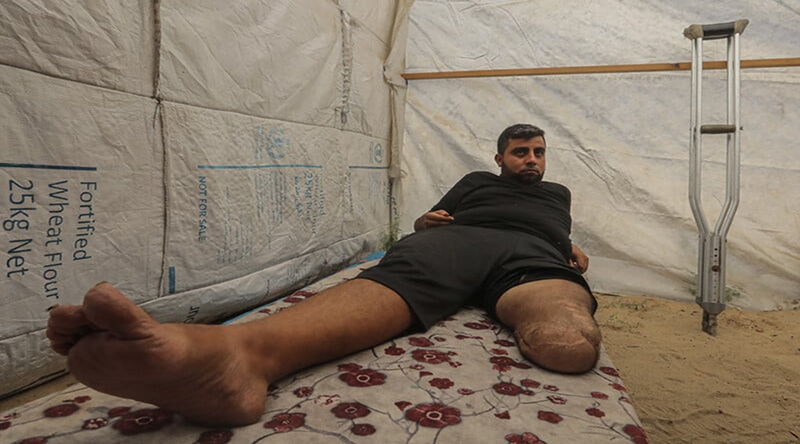 İyileşmesi bir ay, ölmesi üç gün sürdü