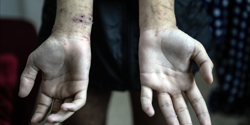 Gazzeli tutuklular en korkunç koşullara maruz kalıyor