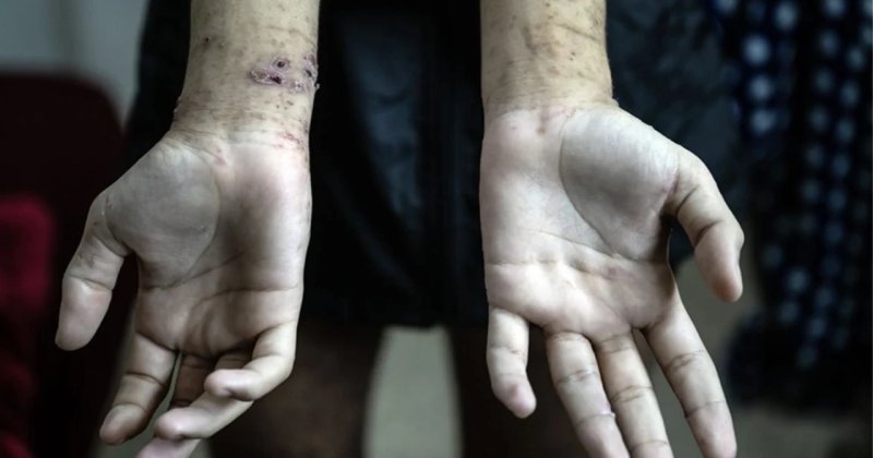 Gazzeli tutuklular korkunç koşullara maruz kalıyor