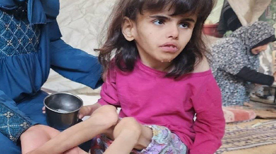 Gazze'deki Kıtlık ve İnsanlığımızın Erozyonu