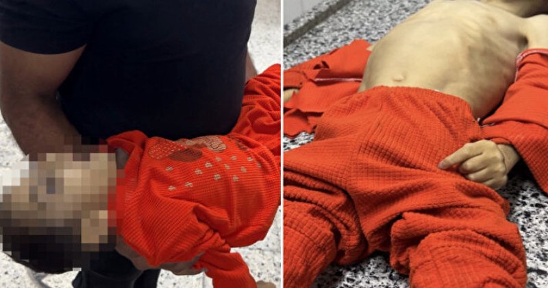 Gazzeli Mustafa'nın minik bedeni açlığa daha fazla dayanamadı