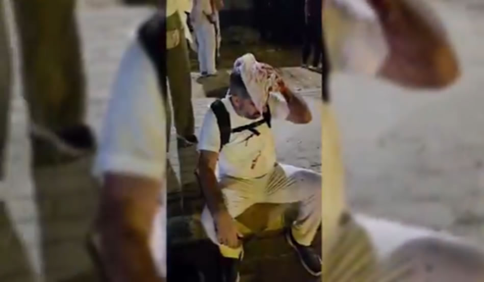 Sisi’nin askerlerinden alçak saldırı: Milletvekili Faruk Dinç yaralandı