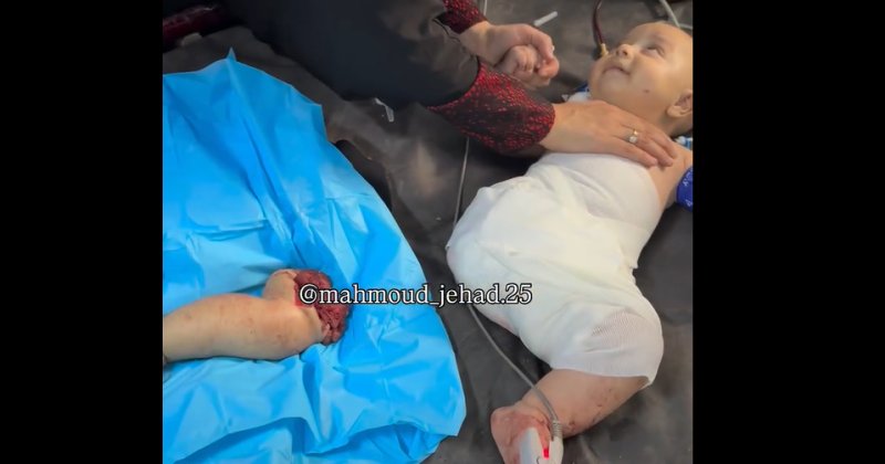 Siyonist katiller bebekleri katletmeye devam ediyor