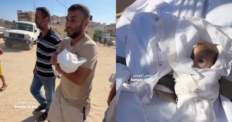 Gazze'de bir bebek daha açlıktan can verdi