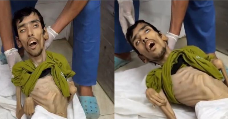 Gazze'de 29 yaşındaki bir genç açlıktan can verdi