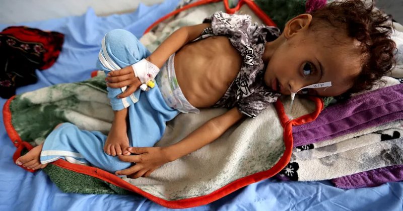 Yemen’de 17 milyondan fazla kişi açlık sınırında