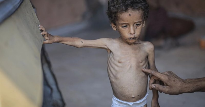 2 yaşındaki Ebu Ful hayati tehlikeyle karşı karşıya!