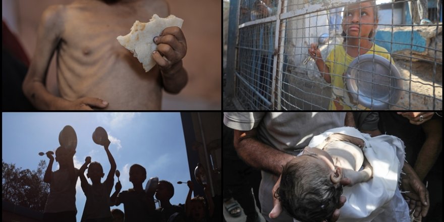 Soykırımcı İsrail saldırıları ve ablukası altındaki Gazze'de açlıktan çocuk ölümleri artıyor