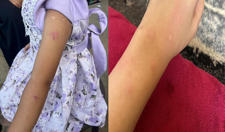 Kum ve deri arasında