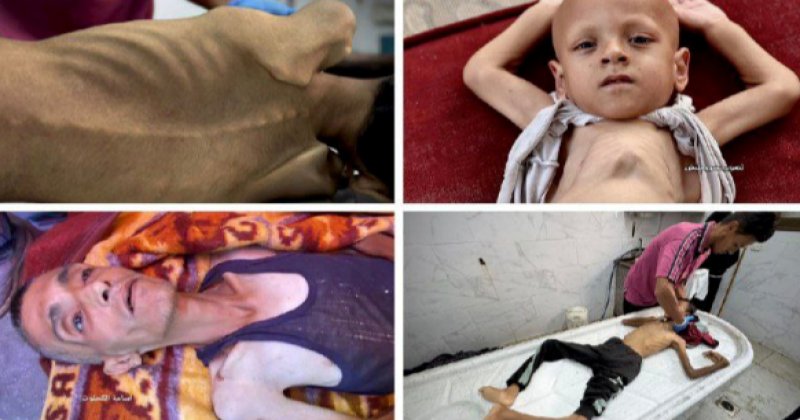 Gazze'de açlık nedeniyle toplu ölümler başladı