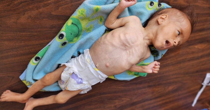 100'den fazla STK Gazze'de “toplu kıtlık” uyarısı yaptı