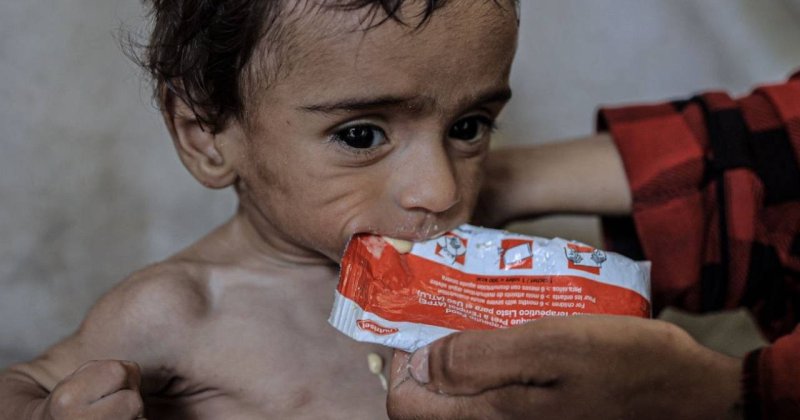 Siyonist abluka Gazze'de kitlesel açlığa yol açtı