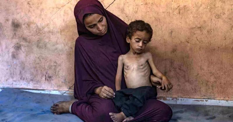 Yeni nesil soykırımın sessiz silahı: Açlık