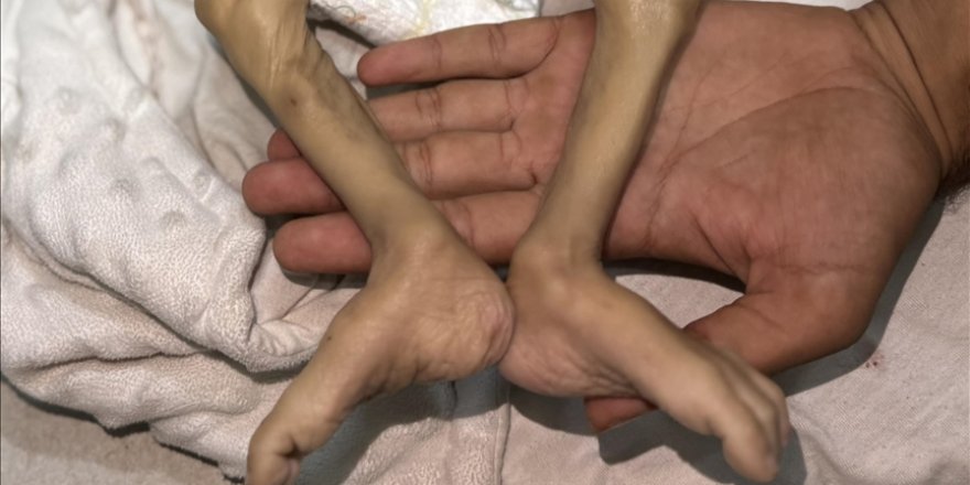 Gazze'de 2'si çocuk 6 Filistinli açlıktan hayatını kaybetti