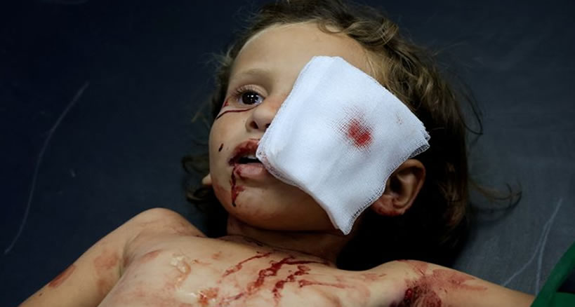 Gazze'de göz tedavisi eğitimi alıyorken her şey karardı